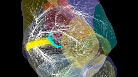 GRoßstrukturen im lokalen KOsmos