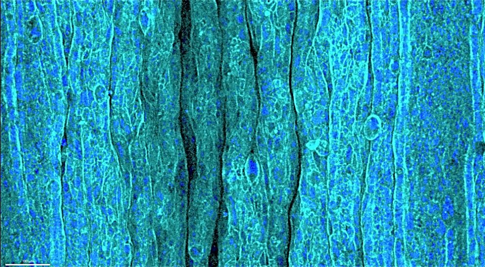 Falten im experimentellen Gewebemodell