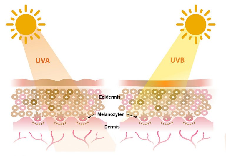 Vom Sonnenstrahl Bis Zum Melanom - Scinexx.de