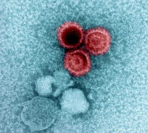 Elektronenmikroskopieaufnahme, die drei rot eingefärbte Partikel des Epstein-Barr-Virus (EBV) zeigt