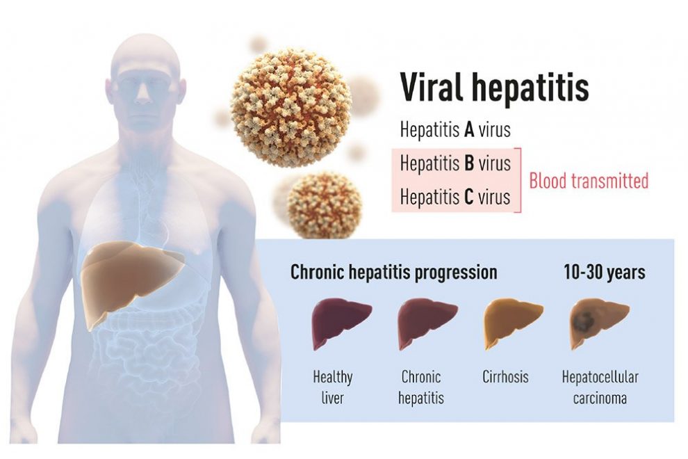 Medizin-Nobelpreis Für Entdecker Des Hepatitis-C-Virus - Drei Forscher ...