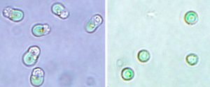 Rotalge und Chloroplasten