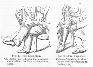 medizinische Zeichnung des Kniesehnenreflexes von 1886