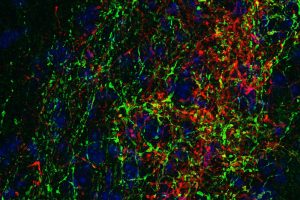 Neuronen im Colliculus inferior