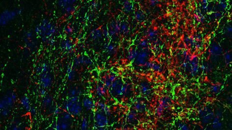 Neuronen im Colliculus inferior