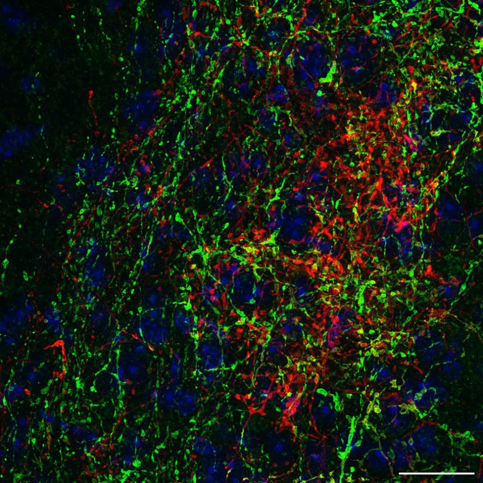 Neuronen im Colliculus inferior