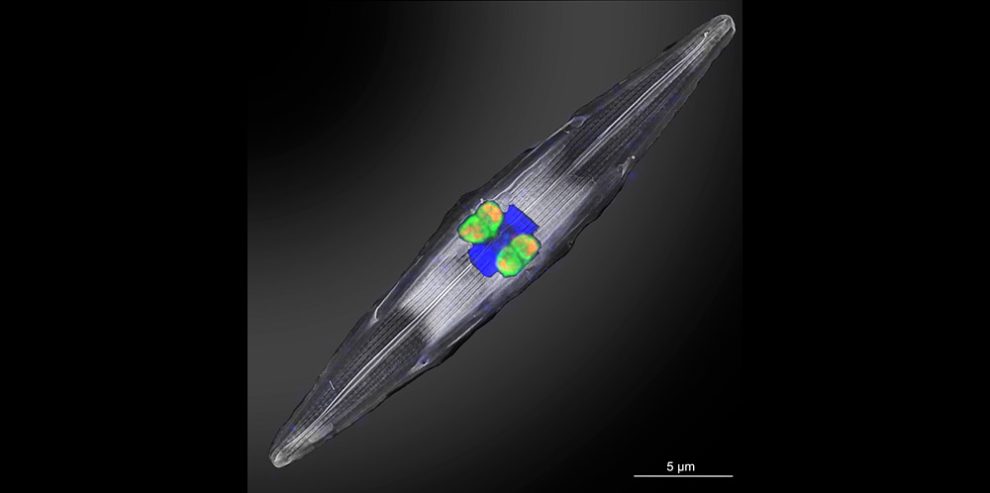 Kieselalge mit Symbionten
