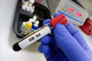 Blutprobe mit der Aufschrift H5N1-Test